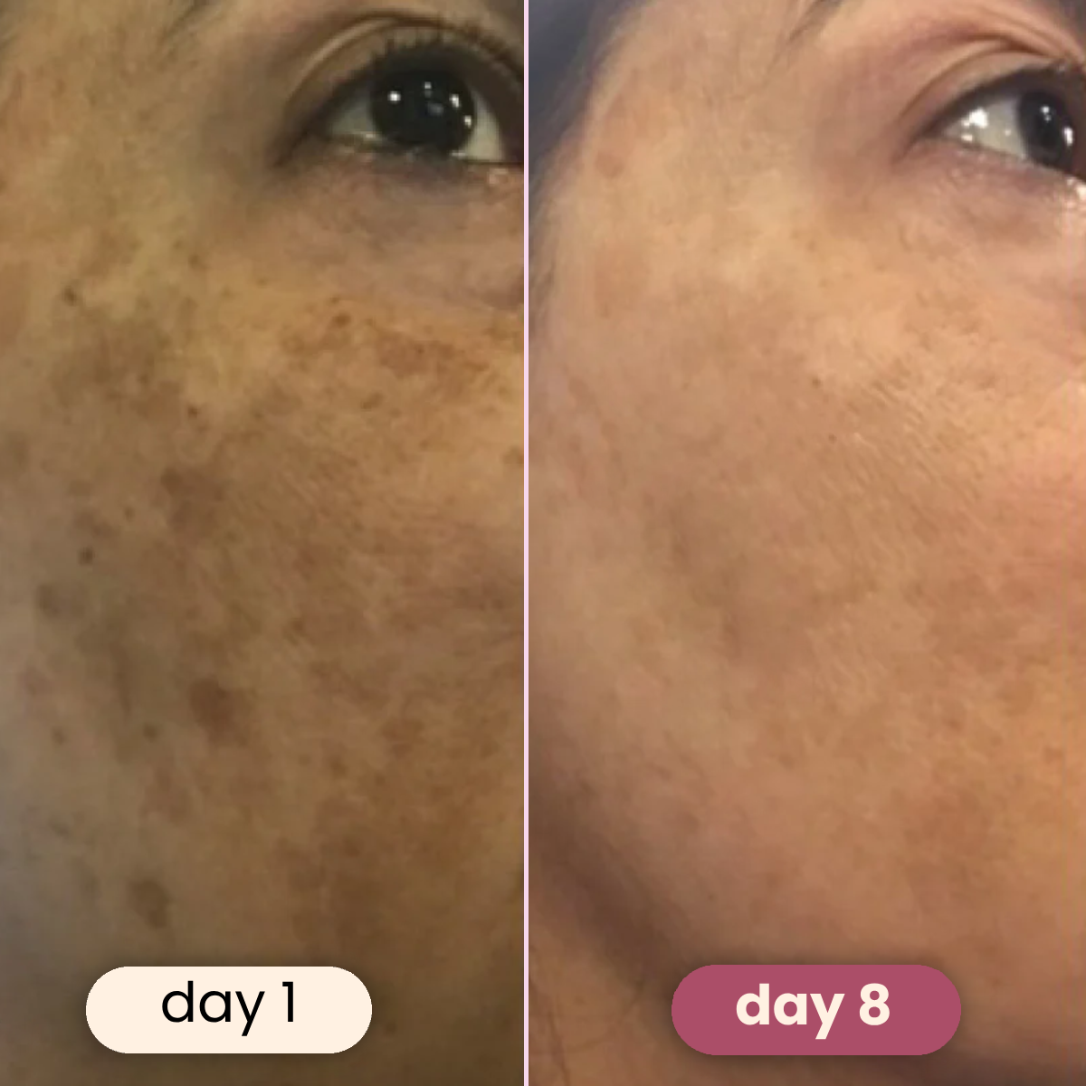 Brightening turmeric & kojic acid pads