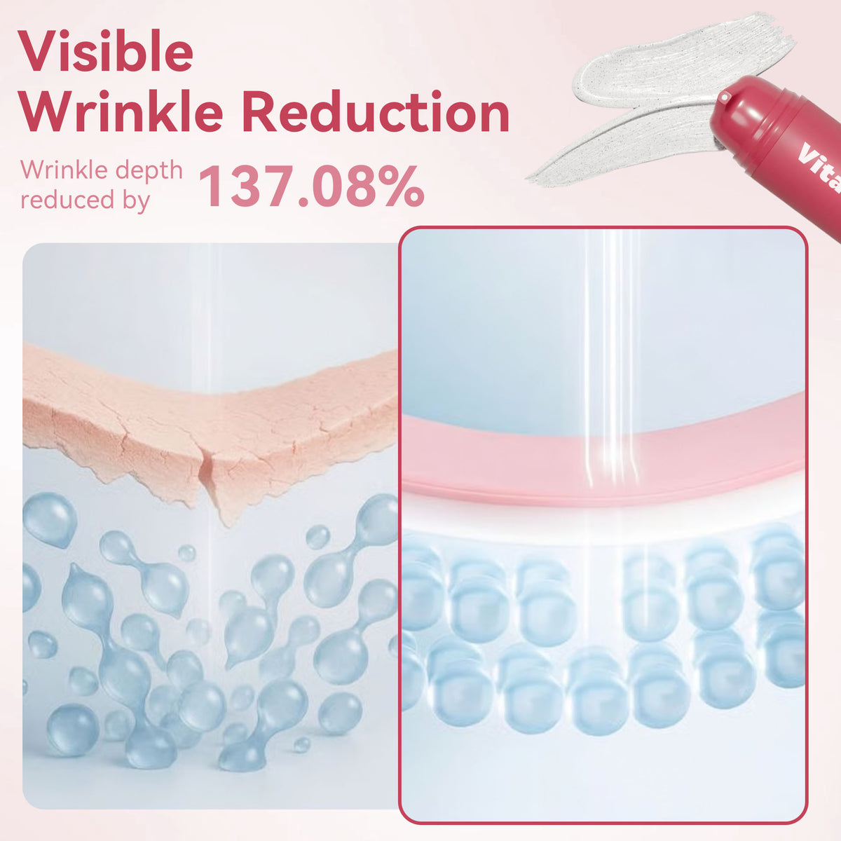 Reverse-aging Adaptive Foundation