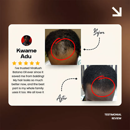 Batana Natural Hair Growth Oil 2.0