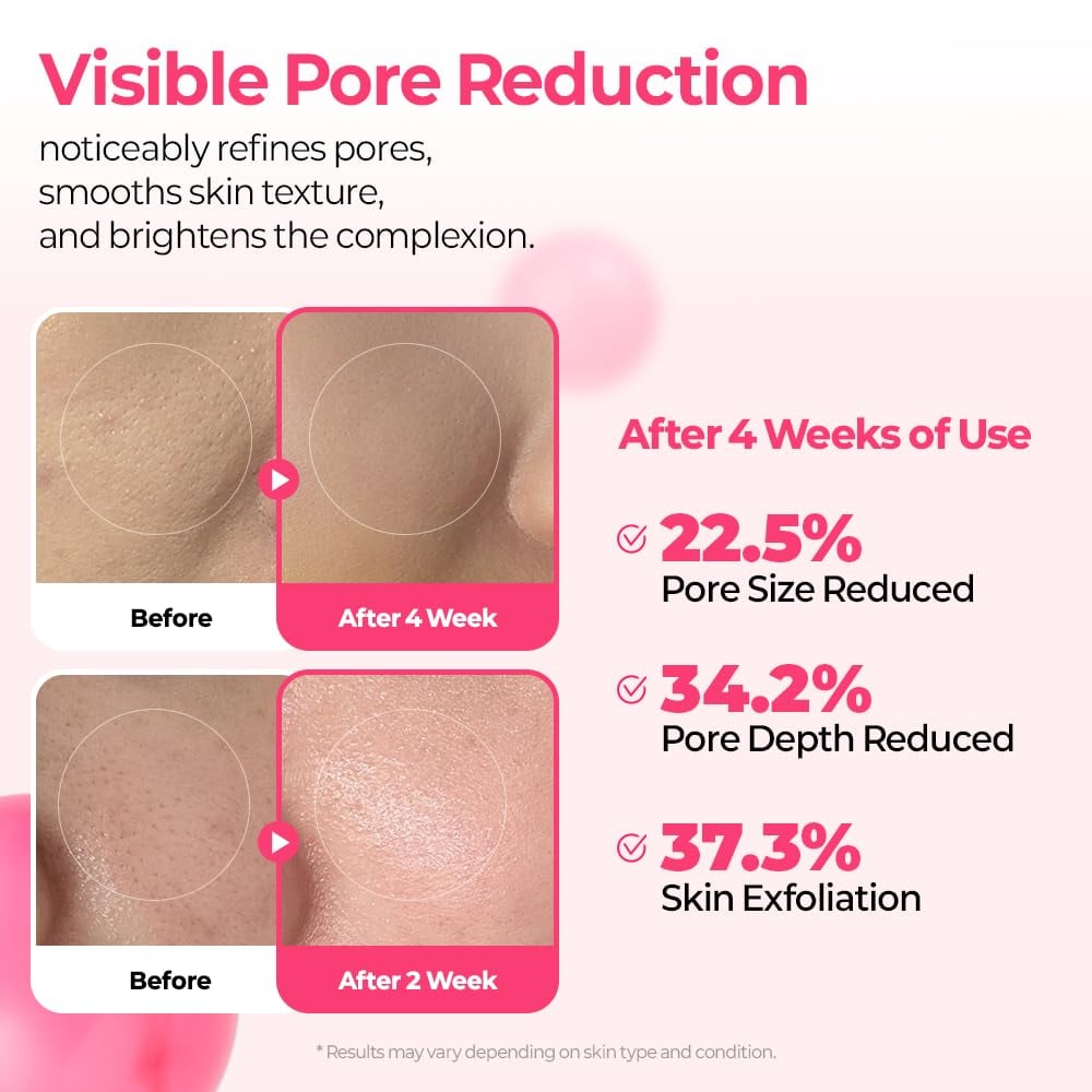 Pore & Spot Care Duo