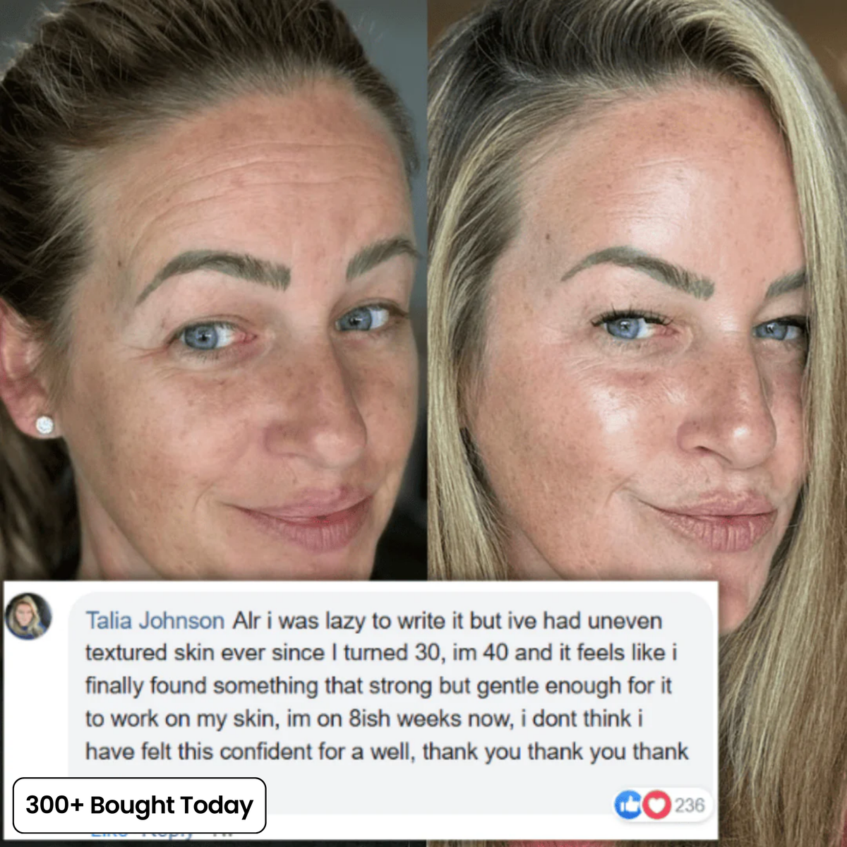 Transform Wrinkles, Fine Lines, And Tired Creases Naturally