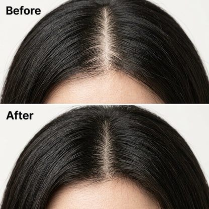 Korean Scalp Revival Bar
